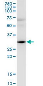 HEY2 Monoclonal Antibody (2B10)