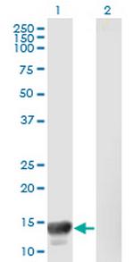MACF1 Monoclonal Antibody (1G9)