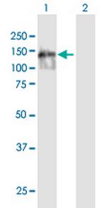 KIAA0146 Polyclonal Antibody, MaxPab™