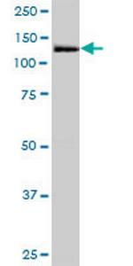 MORC3 Polyclonal Antibody, MaxPab™