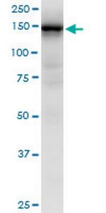 HMHA1 Monoclonal Antibody (4H7)