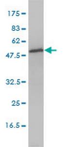 DNPEP Monoclonal Antibody (2F9-3A7)
