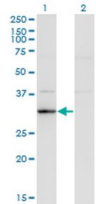 RASD2 Monoclonal Antibody (1C7)