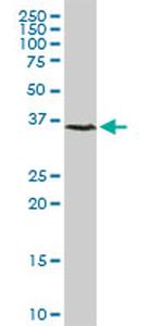 CCRK Antibody in Western Blot (WB)