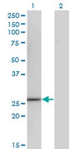 CCRK Monoclonal Antibody (3E11)