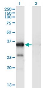 WBP2 Monoclonal Antibody (3B1)