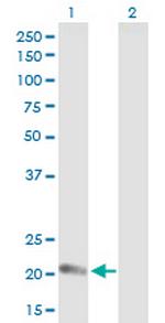 CLDN14 Antibody in Western Blot (WB)