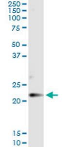 CLDN14 Monoclonal Antibody (3D11)