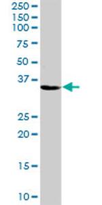 ZNF346 Antibody in Western Blot (WB)