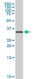 ZNF346 Antibody in Western Blot (WB)