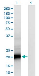 SMUG1 Monoclonal Antibody (4D5)
