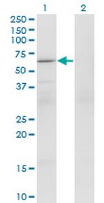 PATZ1 Antibody in Western Blot (WB)