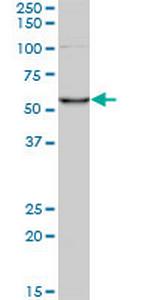 CORO1C Monoclonal Antibody (1F7)
