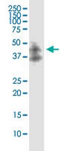 DAPK2 Monoclonal Antibody (3D4)