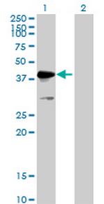 MKRN2 Antibody in Western Blot (WB)
