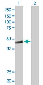 MKRN2 Antibody in Western Blot (WB)