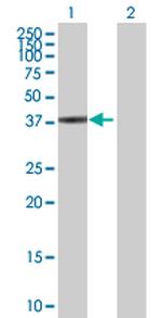 SPO11 Polyclonal Antibody, MaxPab™