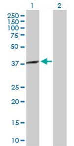 SPO11 Polyclonal Antibody, MaxPab™