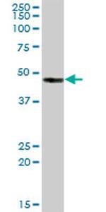 CA14 Antibody in Western Blot (WB)