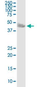 CA14 Antibody in Western Blot (WB)