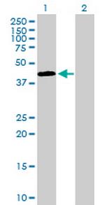 SSBP2 Antibody in Western Blot (WB)