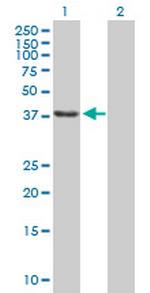 SSBP2 Polyclonal Antibody, MaxPab™