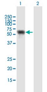 NUP62 Antibody in Western Blot (WB)