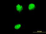NUP62 Monoclonal Antibody (2D3)