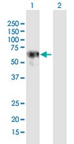 LRRC6 Polyclonal Antibody, MaxPab™