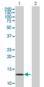 LDOC1 Antibody in Western Blot (WB)