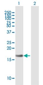 LY96 Antibody in Western Blot (WB)