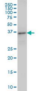 ARFIP2 Monoclonal Antibody (2B5)