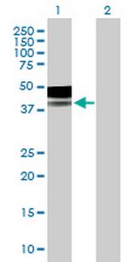 PLA2G15 Antibody in Western Blot (WB)