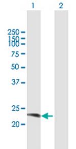 RAB38 Polyclonal Antibody, MaxPab™