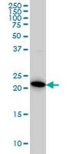 RAB38 Monoclonal Antibody (7F1)