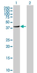 BHMT2 Polyclonal Antibody, MaxPab™