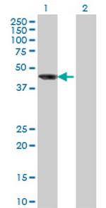 AIPL1 Monoclonal Antibody (1E1)