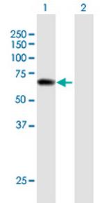 PPIL2 Antibody in Western Blot (WB)