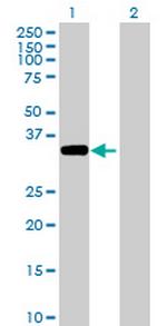 ACTBL1 Antibody in Western Blot (WB)