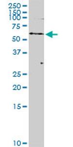 POTEH Antibody in Western Blot (WB)