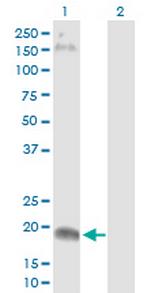 CLDN15 Antibody in Western Blot (WB)