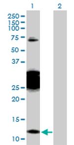 CBY1 Antibody in Western Blot (WB)