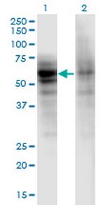 DSTYK Monoclonal Antibody (1F9)