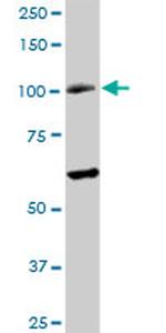 RAD54B Antibody in Western Blot (WB)