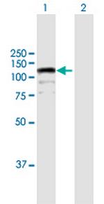 CIZ1 Polyclonal Antibody, MaxPab™