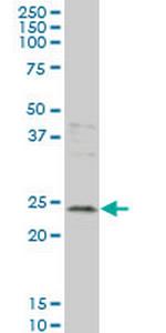 GCA Monoclonal Antibody (2F5)