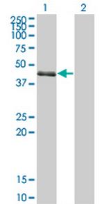 SPDEF Monoclonal Antibody (4A5)