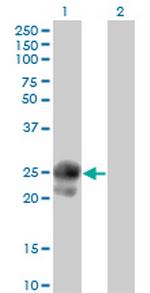 BAMBI Monoclonal Antibody (3C1-1D1)