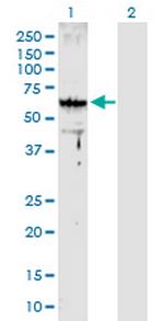 ARMC8 Antibody in Western Blot (WB)
