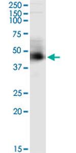 ARMC8 Antibody in Immunoprecipitation (IP)